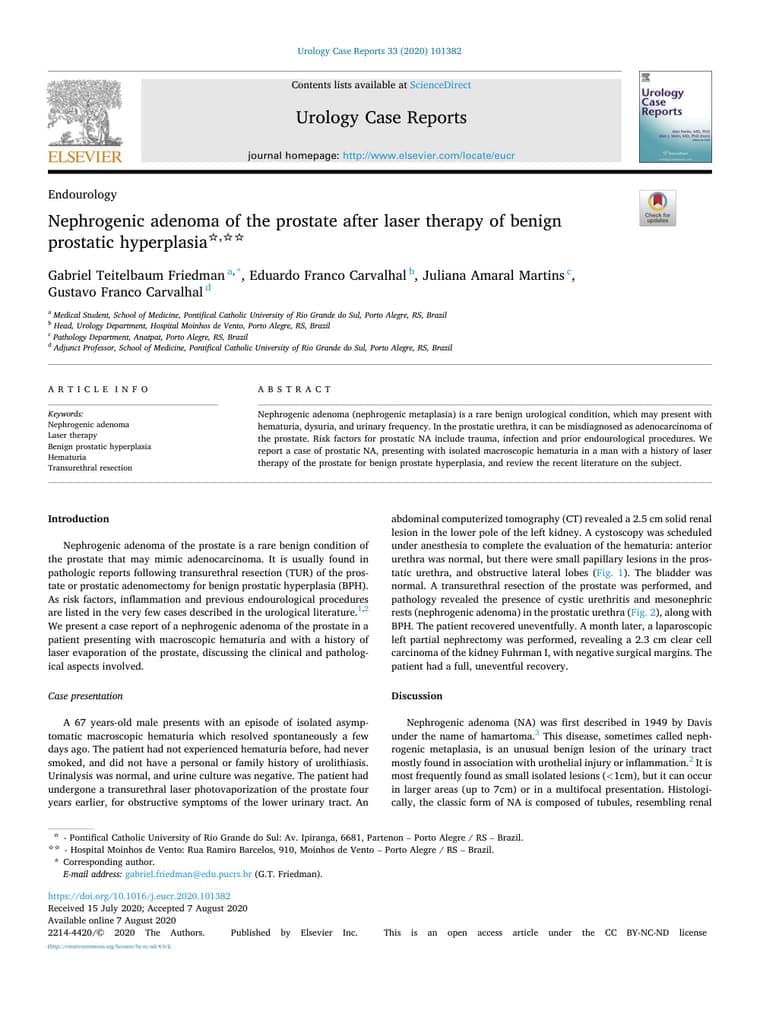 Primeira página do artigo: Nephrogenic adenoma of the prostate after laser therapy of benign prostatic hyperplasia