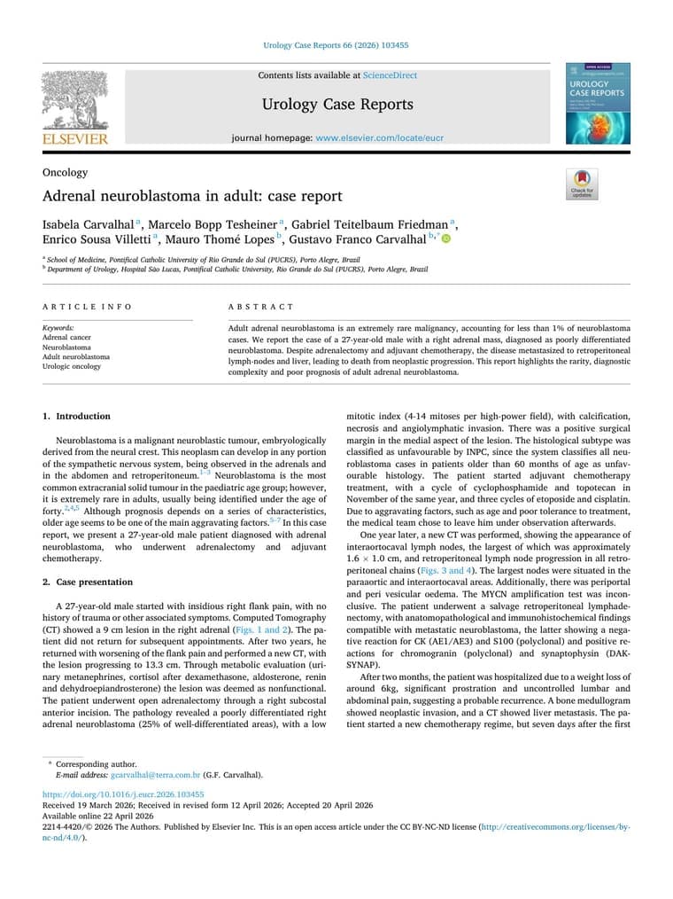 Primeira página do artigo: Adrenal neuroblastoma in adult: case report